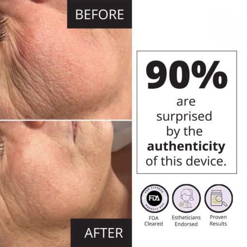 7E Wellness MyoLift Mini Microcurrent Facial Device - Non-Invasive Face Lift, Facial Skin Care Products for Anti Aging, Skin Tightening - Esthetician Supplies and Skin Care Tools - Up to 400 Microamps - Image 4