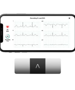 KardiaMobile 6-Lead Personal EKG Monitor – Six Views of The Heart – Detects AFib and Irregular Arrhythmias – Instant Results in 30 Seconds – Works with Most Smartphones - FSA/HSA Eligible